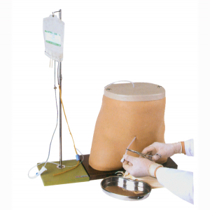 Peritoneal dialysis model: leading the new trend of healthy dialysis