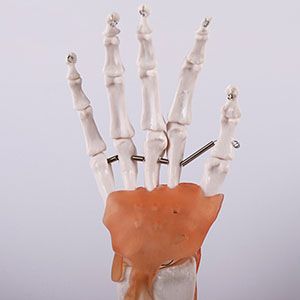 Hand joint model ligamentum: Can it meet both teaching and clinical needs?