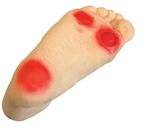 Diabetic foot Care Model: Can it be an essential tool in diabetes care education?