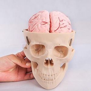 A model of eight parts of cerebral arteries in the skull band