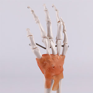 Bone and joint model